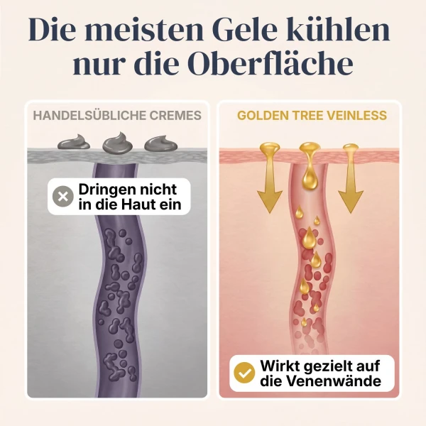 Veinless Gel