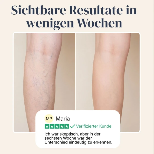 Veinless Gel