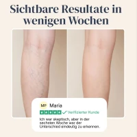 Veinless Gel