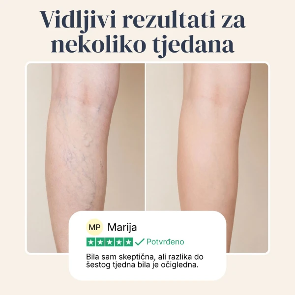 Veinless Gel