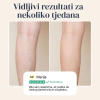 Veinless Gel