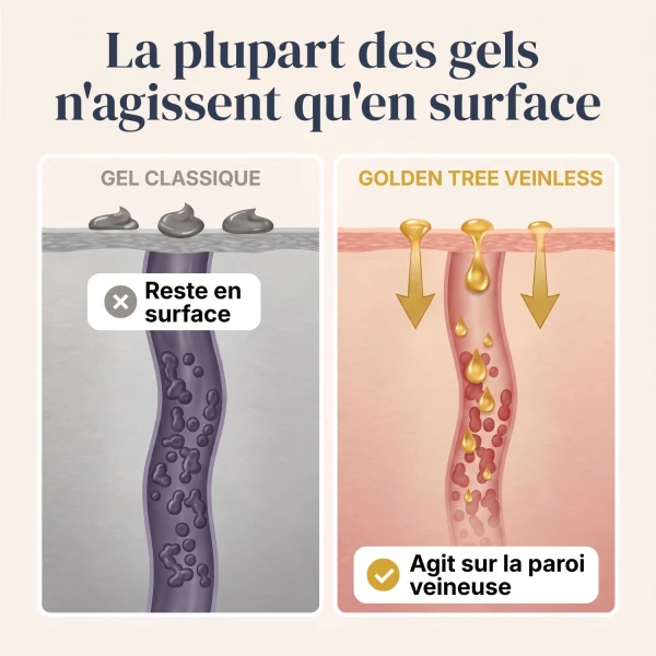 Veinless Gel