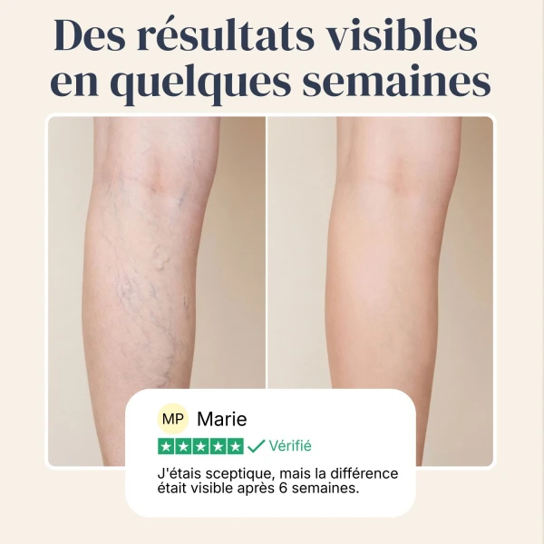 Veinless Gel