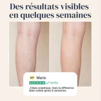 Veinless Gel