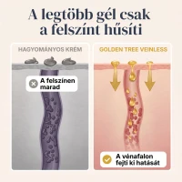 Veinless Gél Szüntesse meg a vénás torlódást, és nyerje vissza a könnyed, kényelmes lábérzetet!