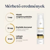 Veinless Gél Szüntesse meg a vénás torlódást, és nyerje vissza a könnyed, kényelmes lábérzetet!