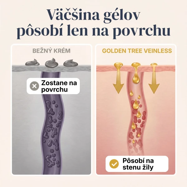 Veinless Gél