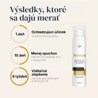 Veinless Gél