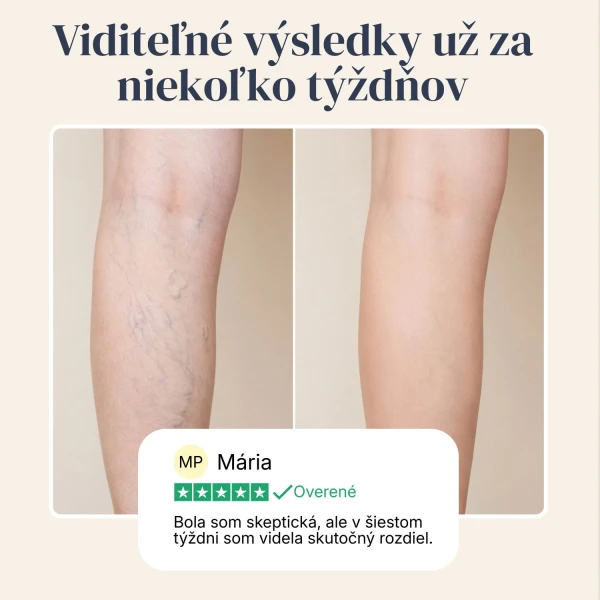 Veinless Gél