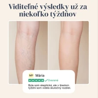 Veinless Gél